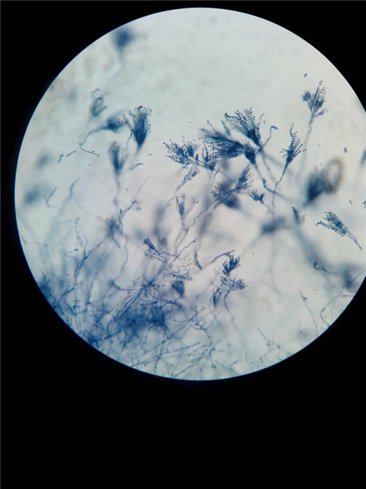 显微镜下的青霉菌图片