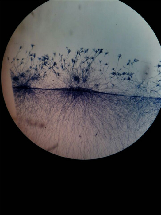 青霉菌显微镜手绘图图片